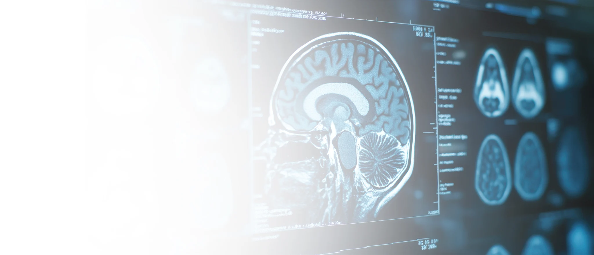 Neurology